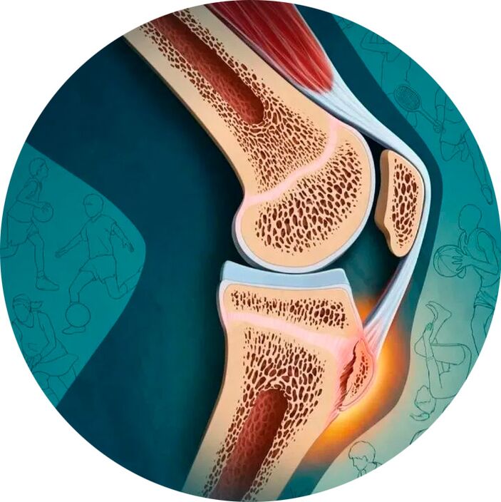 Artikulazioaren eta inguruko ehunen egitura