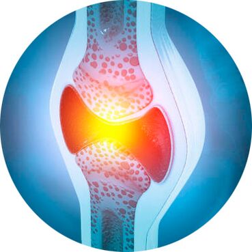 Icexin gelarekin bateratutako zaharberritze prozesua