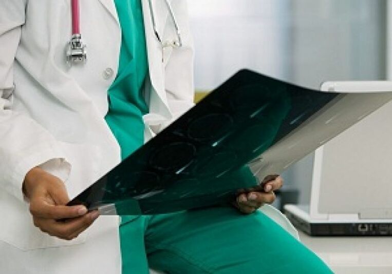X izpiak medikuari bizkarrezurreko toraziko osteokondrosia diagnostikatzen lagunduko dio.